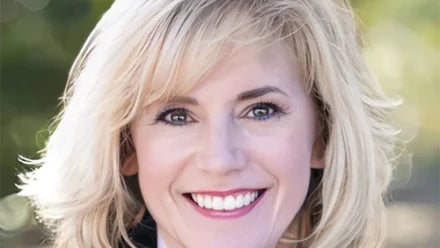 Finding Your Perfect Blonde Wig: Delve Into the Captivating World of Golden Wigs